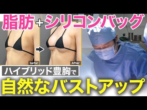 しっかりサイズアップしても縁が目立たない！シリコンバッグ＋脂肪で行う【ハイブリッド豊胸】#美乳 #ビフォーアフターのサムネイル